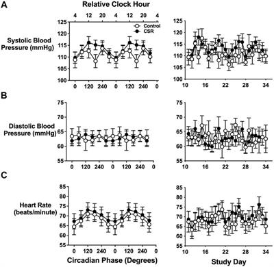 Sleep Restriction and Recurrent Circadian Disruption Differentially Affects Blood Pressure, Sodium Retention, and Aldosterone Secretion